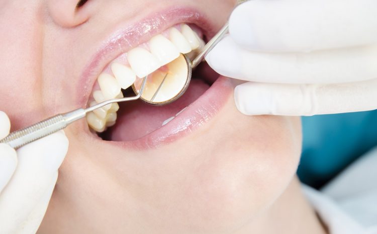 Higienizacja zębów – co to jest i na czym polega